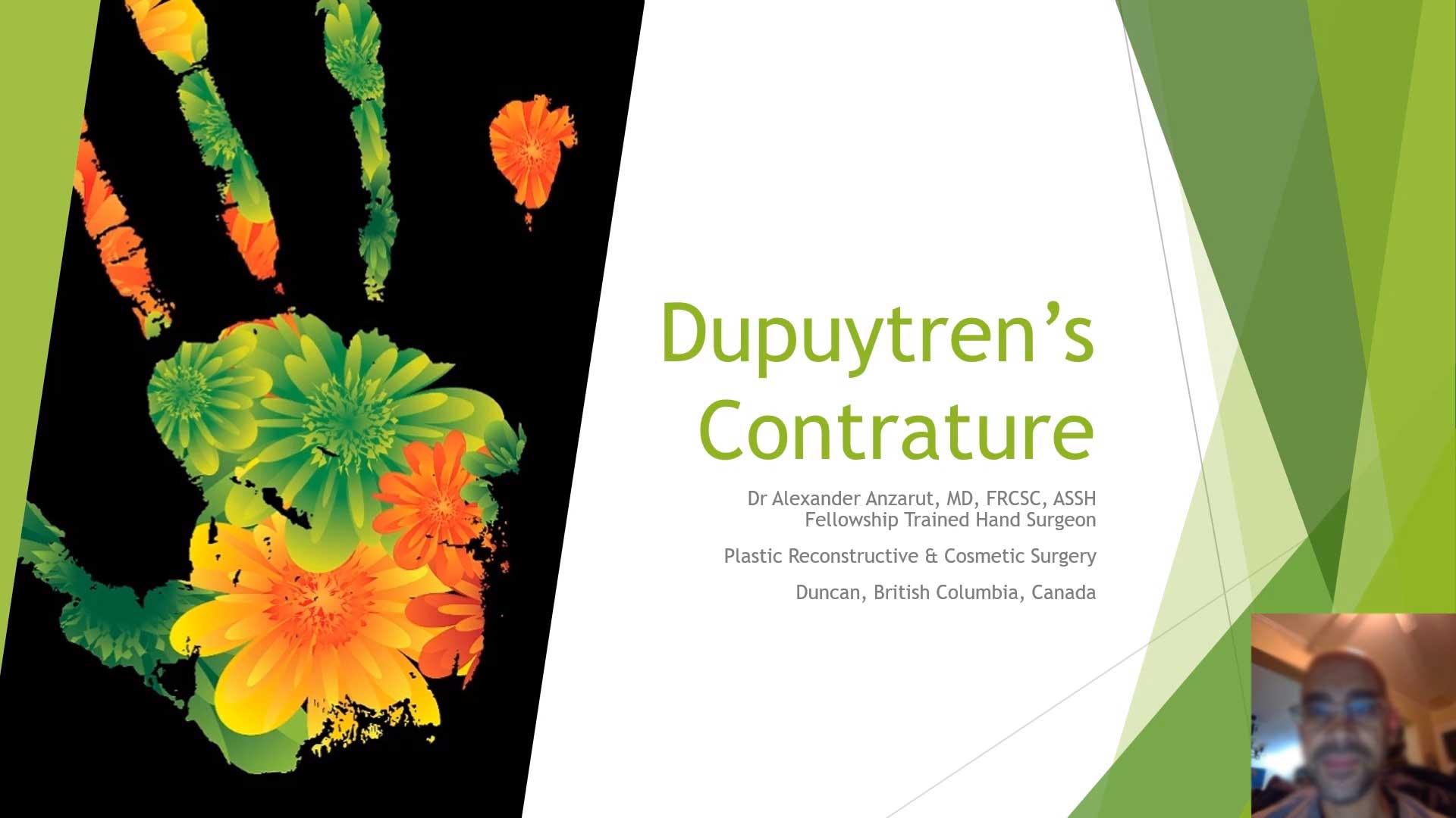 dupuytrens contracture treatment
